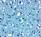 VTI1b Antibody